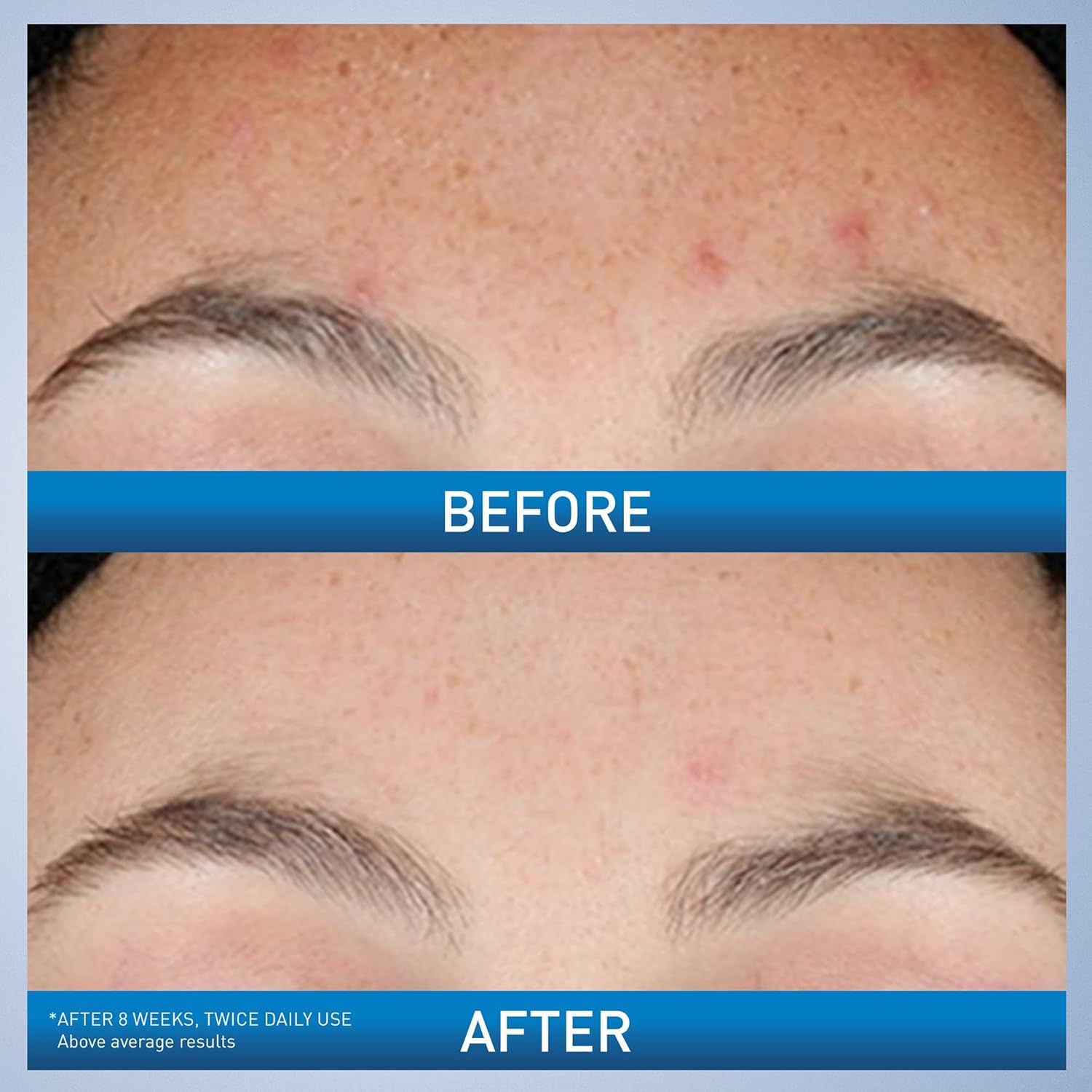 CeraVe Resurfacing Retinol Serum USA