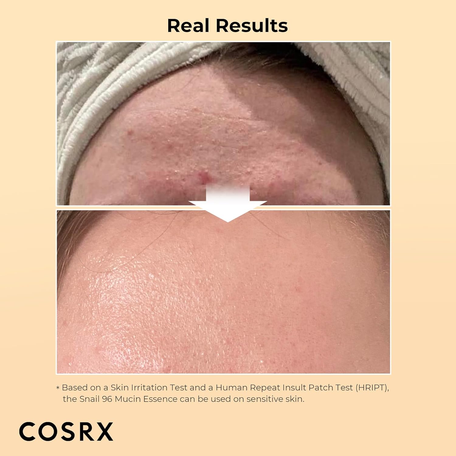 Cosrx - Advanced Snail 96 Mucin Power Essence
