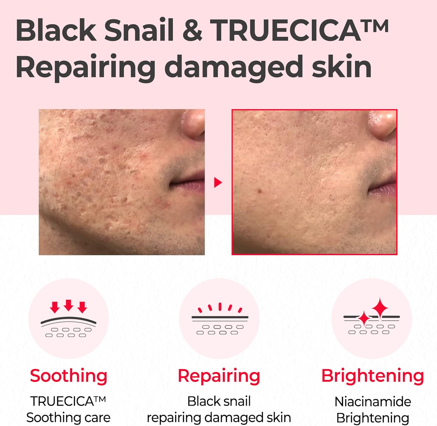 Some By Mi Trucica Miracle Repair Toner