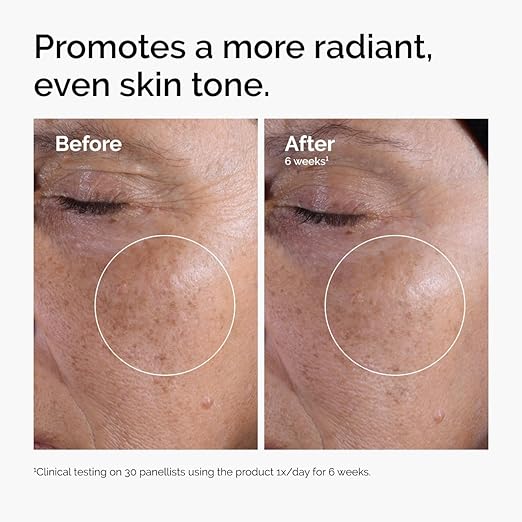 The Ordinary Glycolic Acid 7% Toning Solution