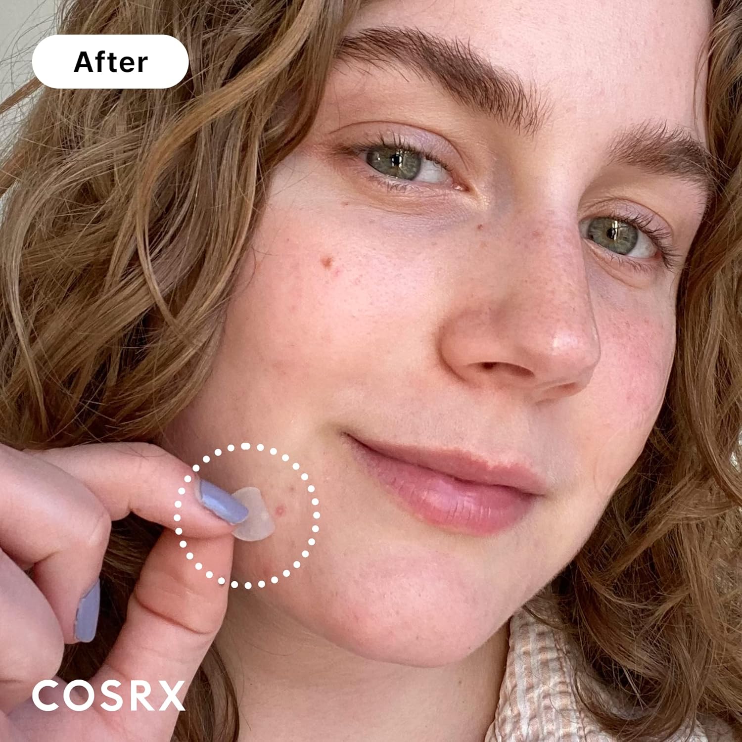 Cosrx Acne Pimple Master Patch (24 Patches)