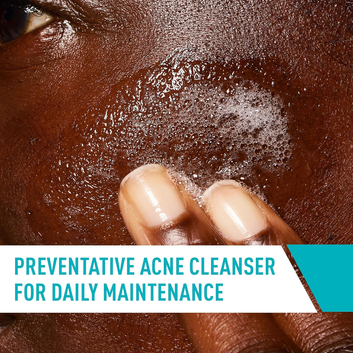 Cerave Acne Control Cleanser USA